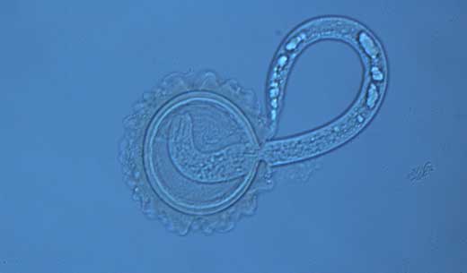 Mikroskopfoto af spoleormslarve på vej ud af ægget 